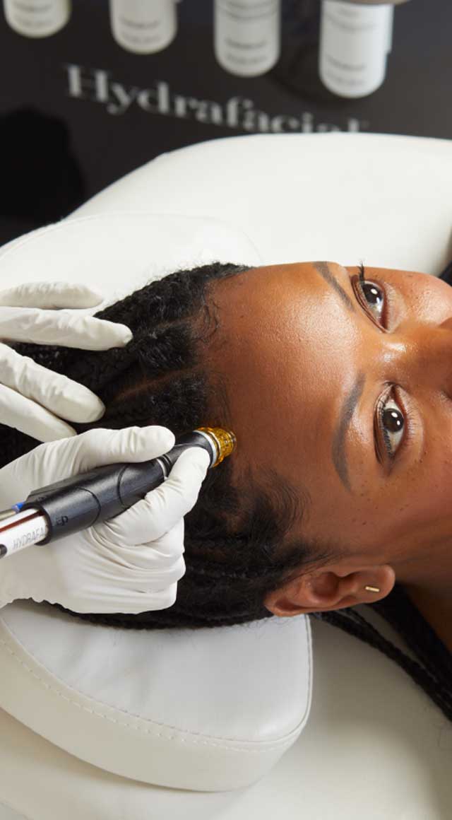Close-up of the HydraFacial Keravive device applied to a woman’s scalp, with hair gently parted to reveal the treatment area, showing the exfoliation and hydration process during this advanced scalp therapy