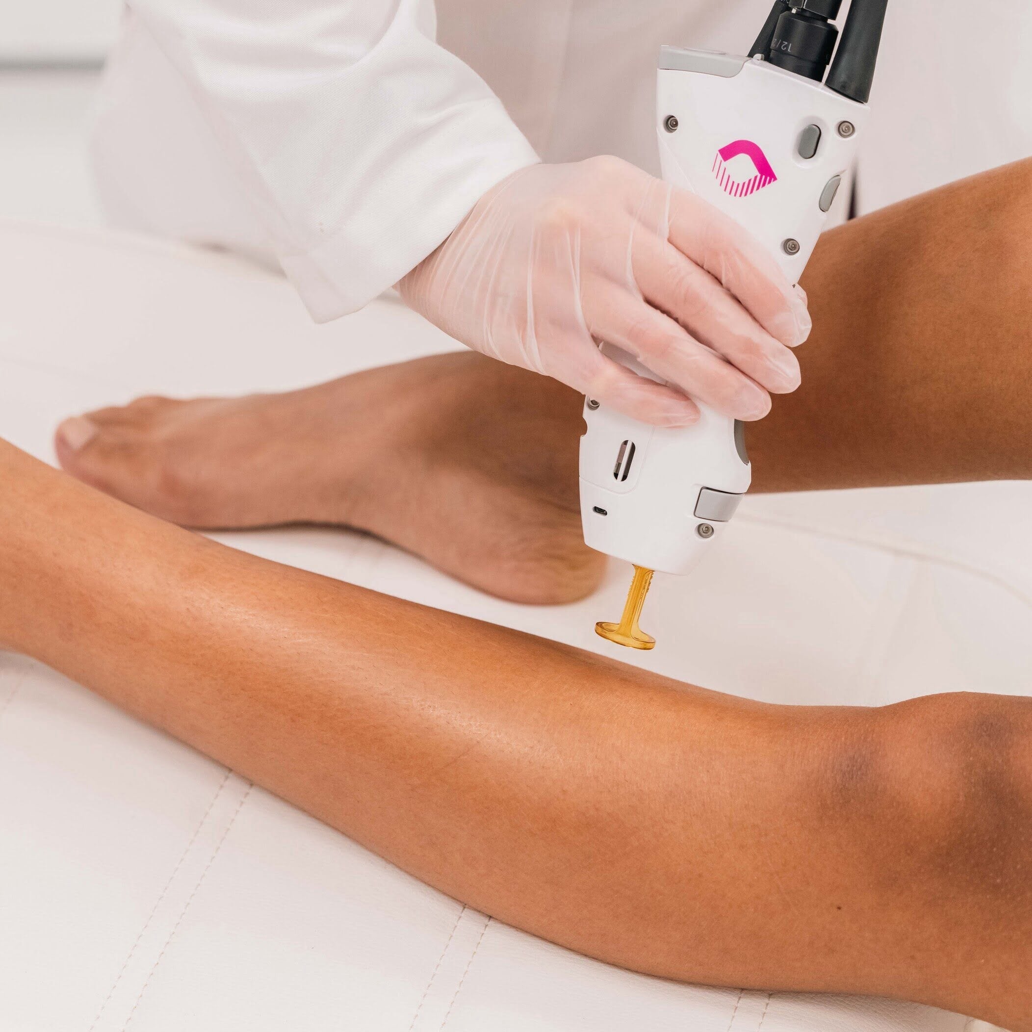 How Effective is Laser Hair Removal?