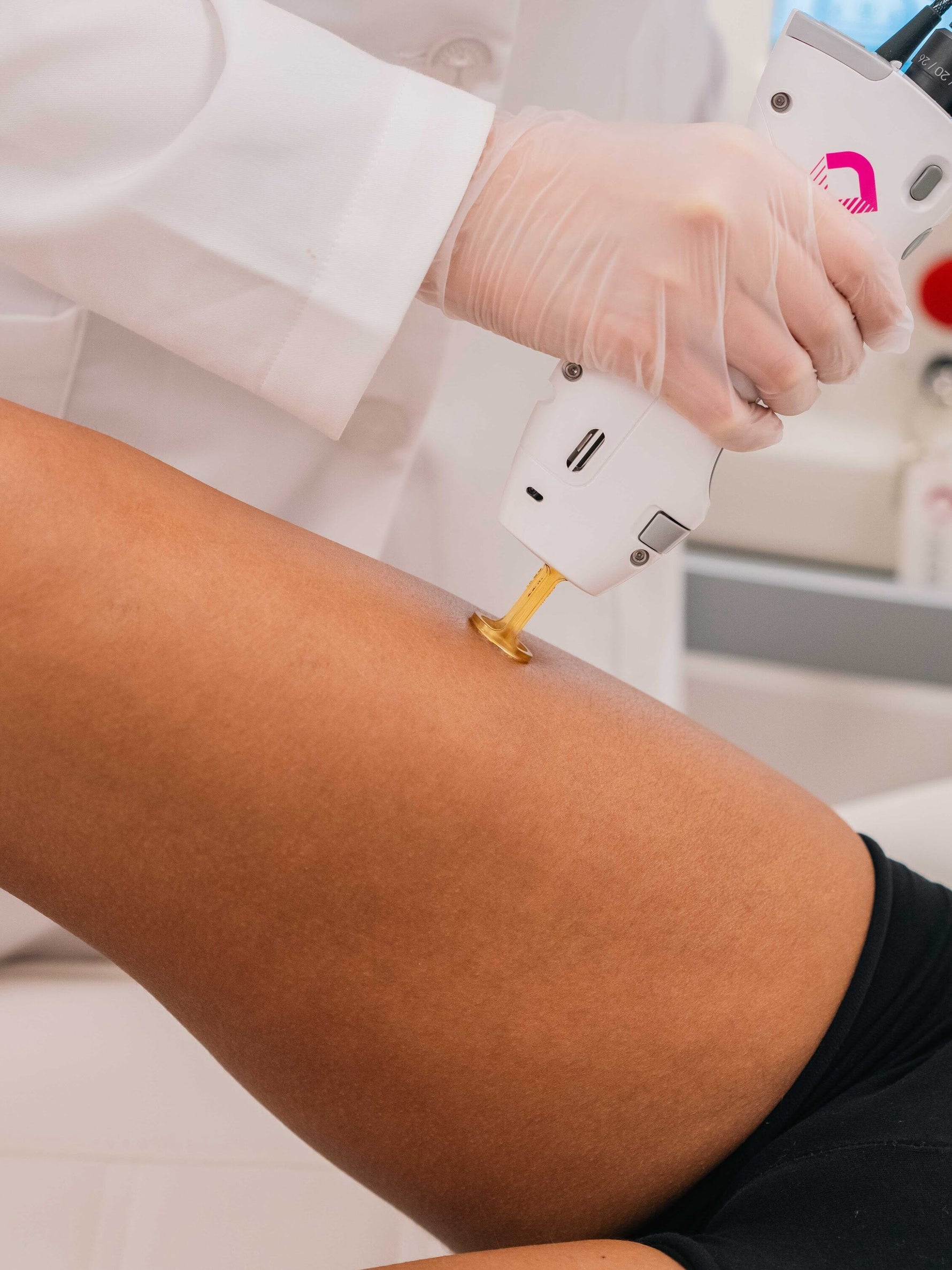 Laser Hair Removal for Men – La Rose Clinic