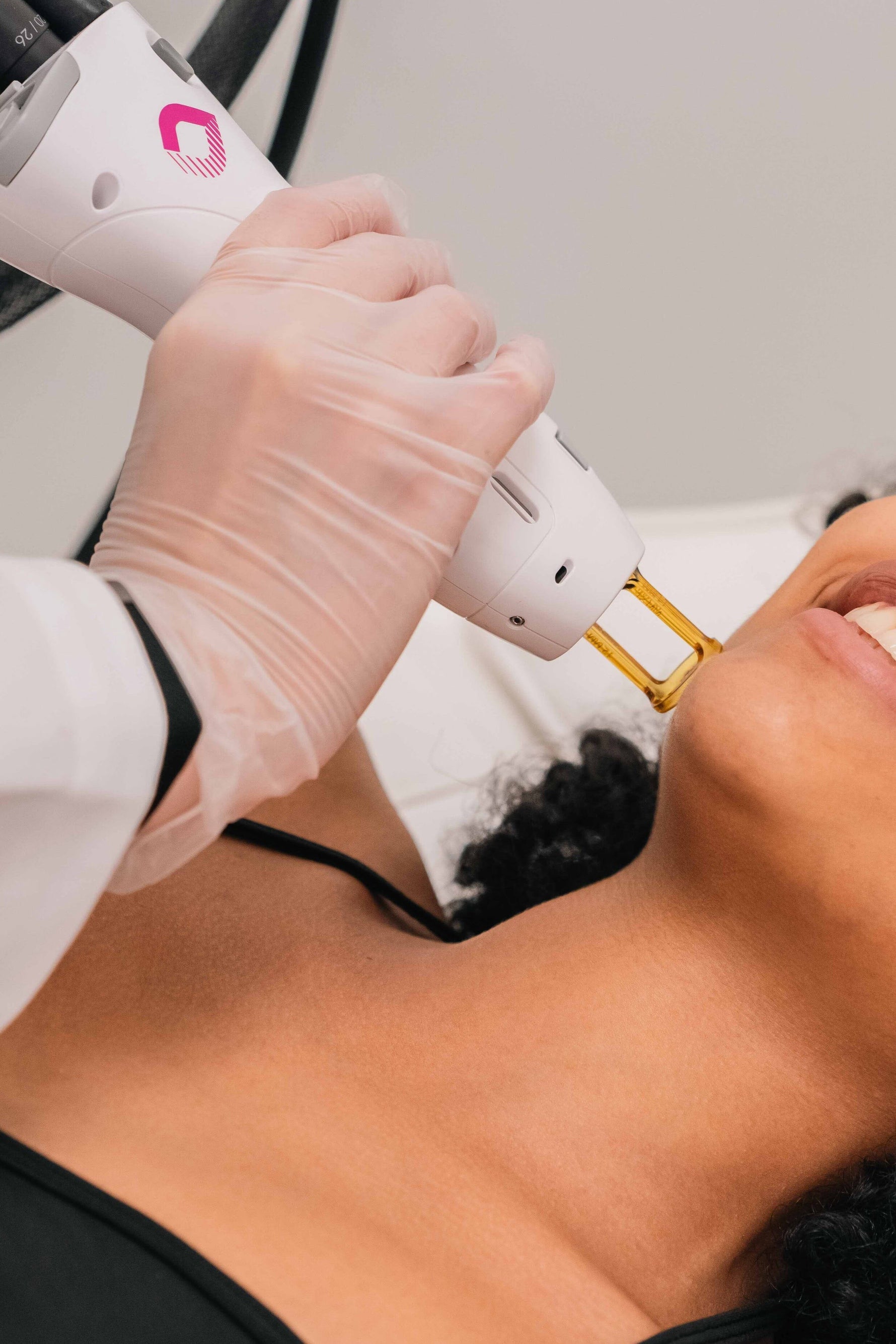 Facial Laser Hair Removal – La Rose Clinic