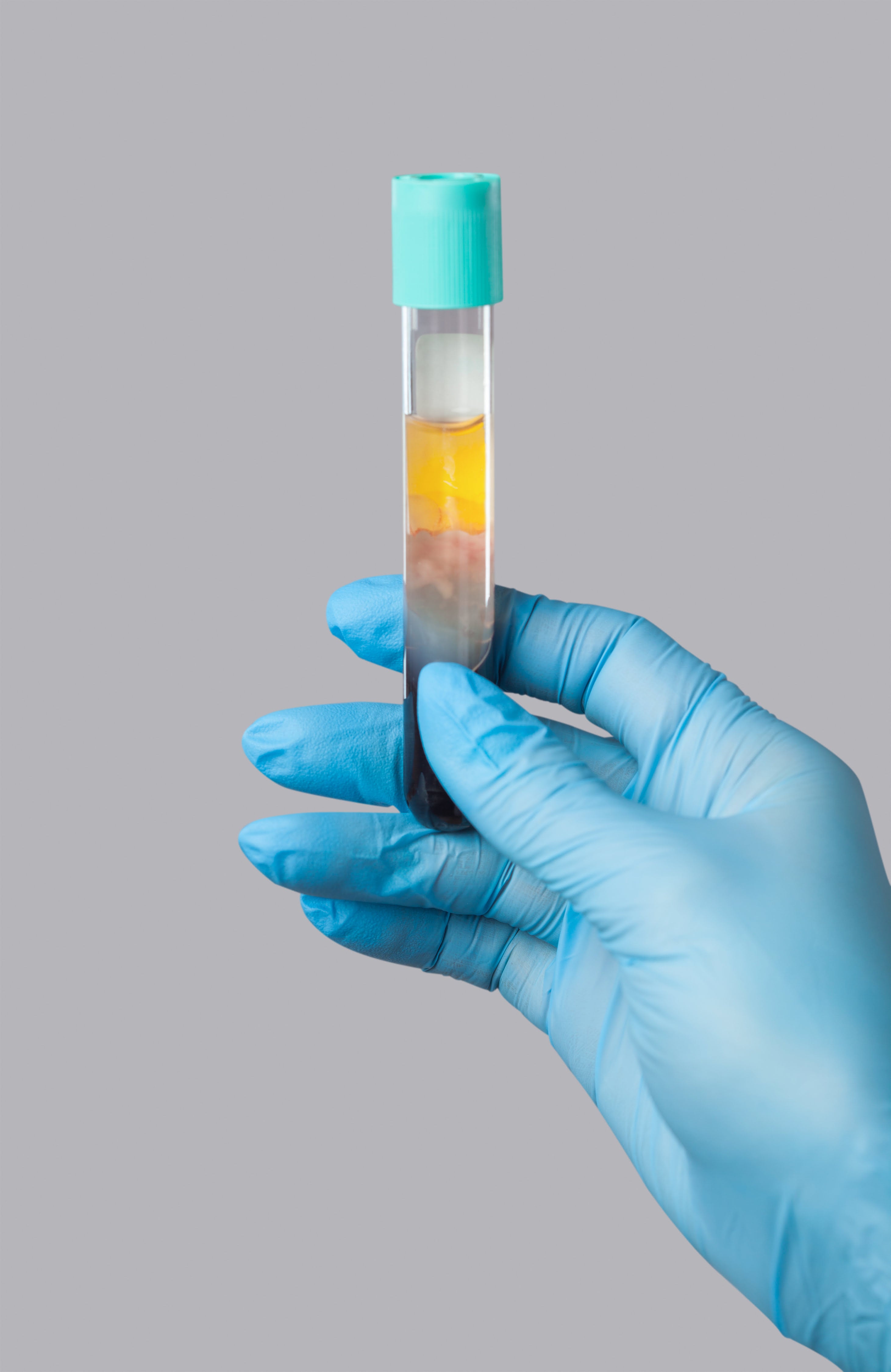 PRP Boost (Platelet-rich plasma)