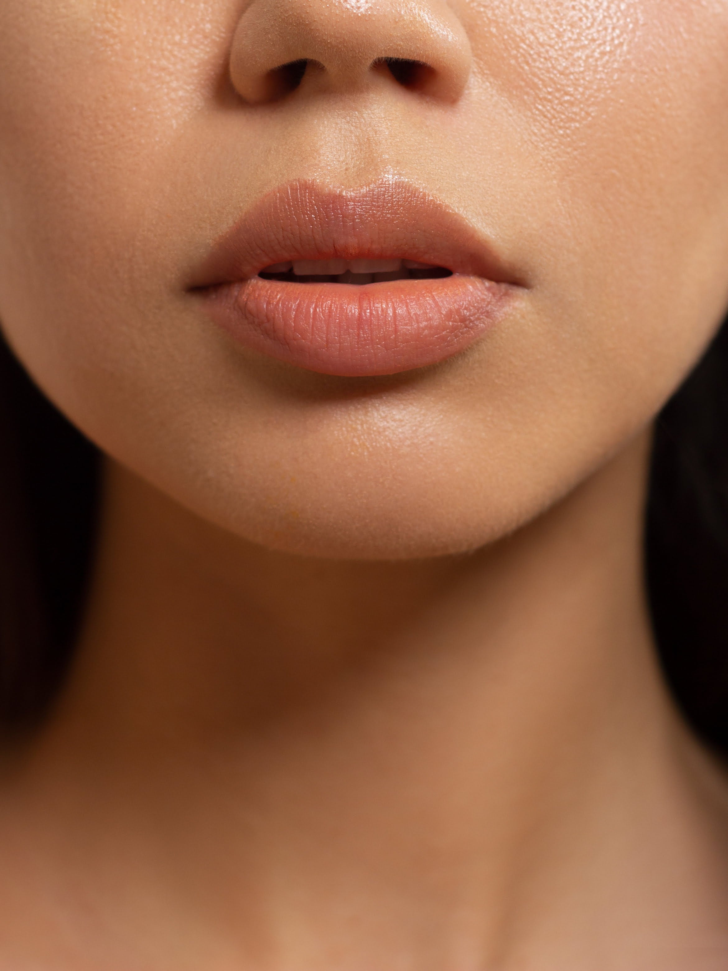 Dermal Fillers