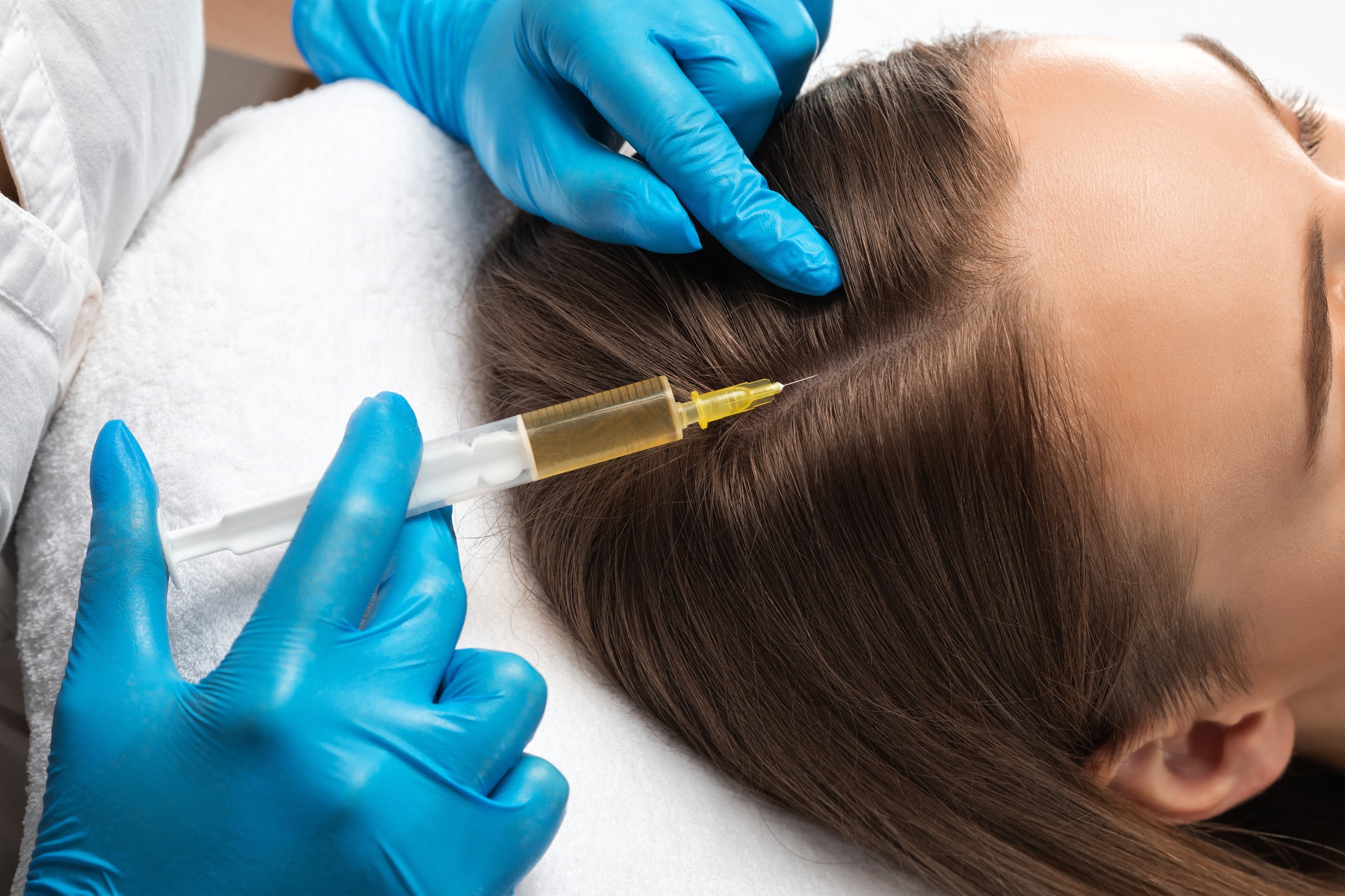 PRP Hair Boost