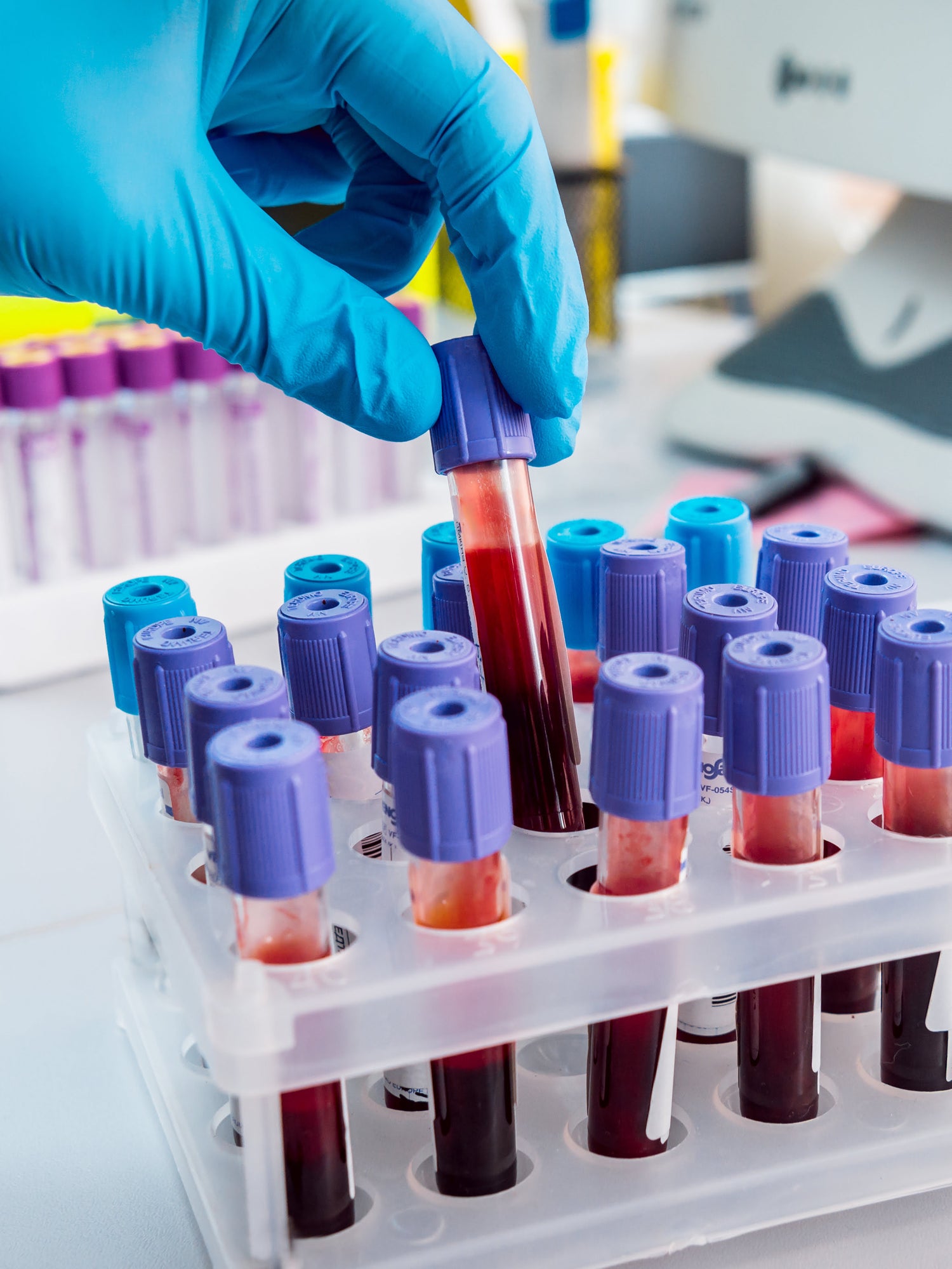Specific Blood Tests