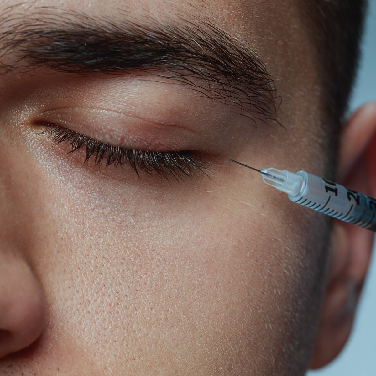 botox & wrinkle relaxers for men