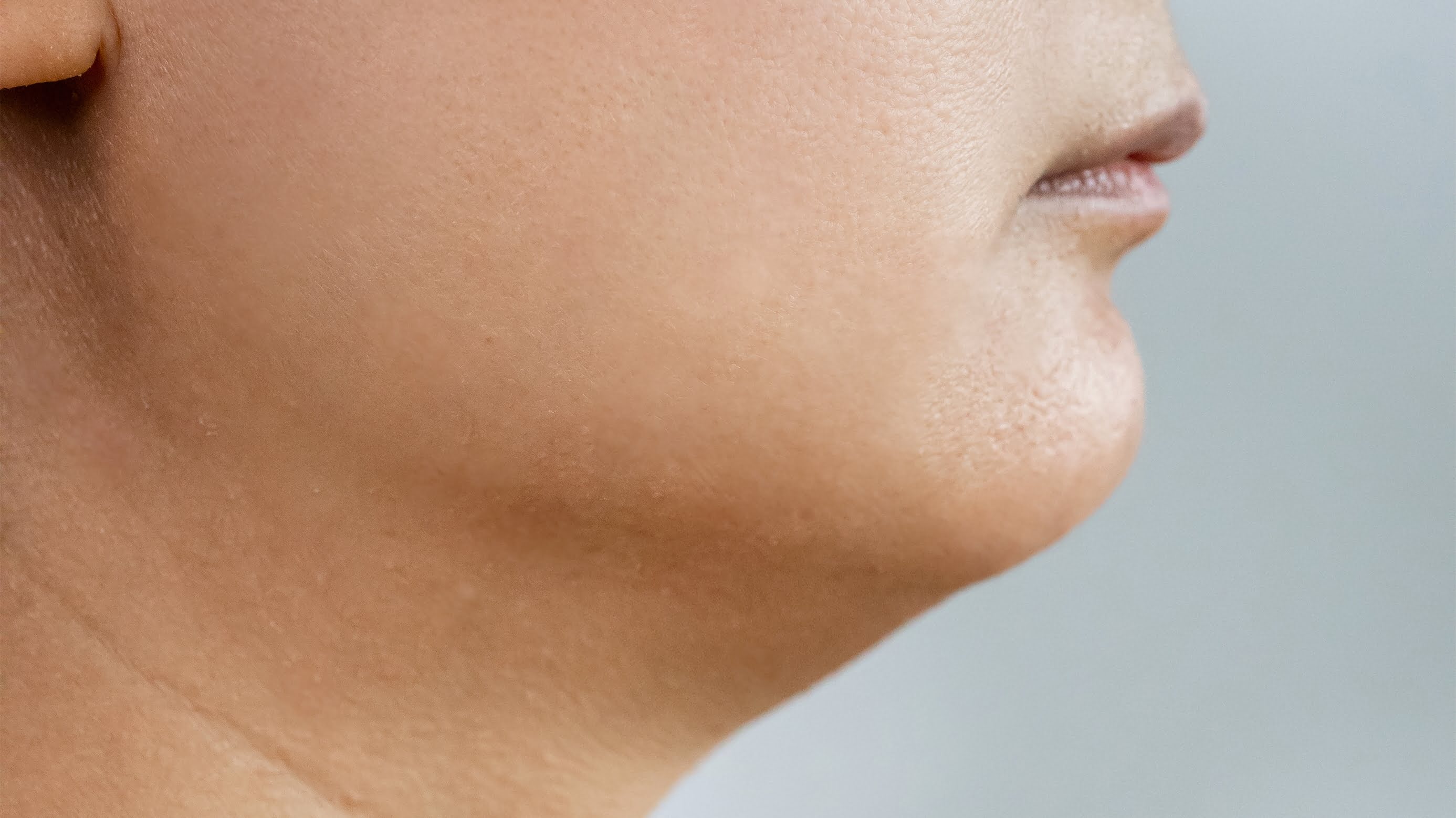 jowls before treatment
