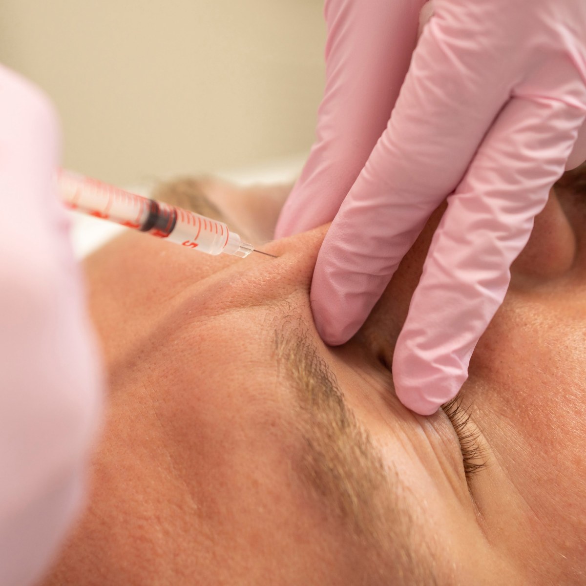 polynucleotides skin therapy for men