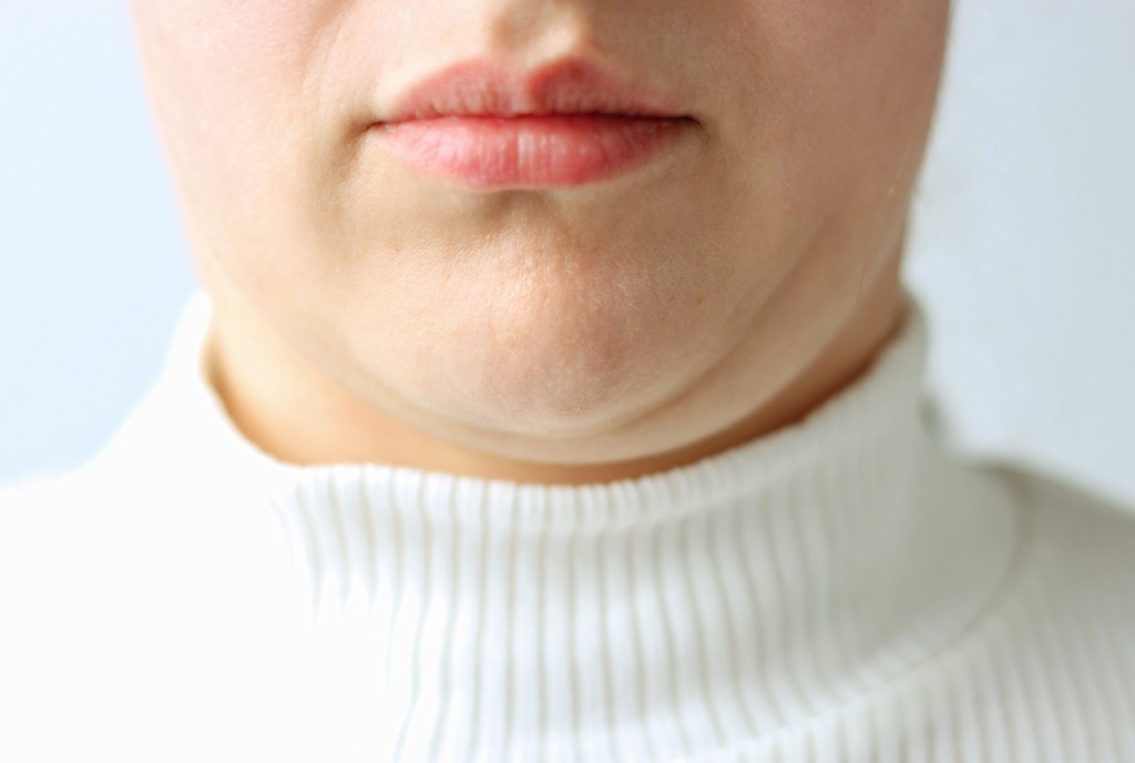 woman jowls