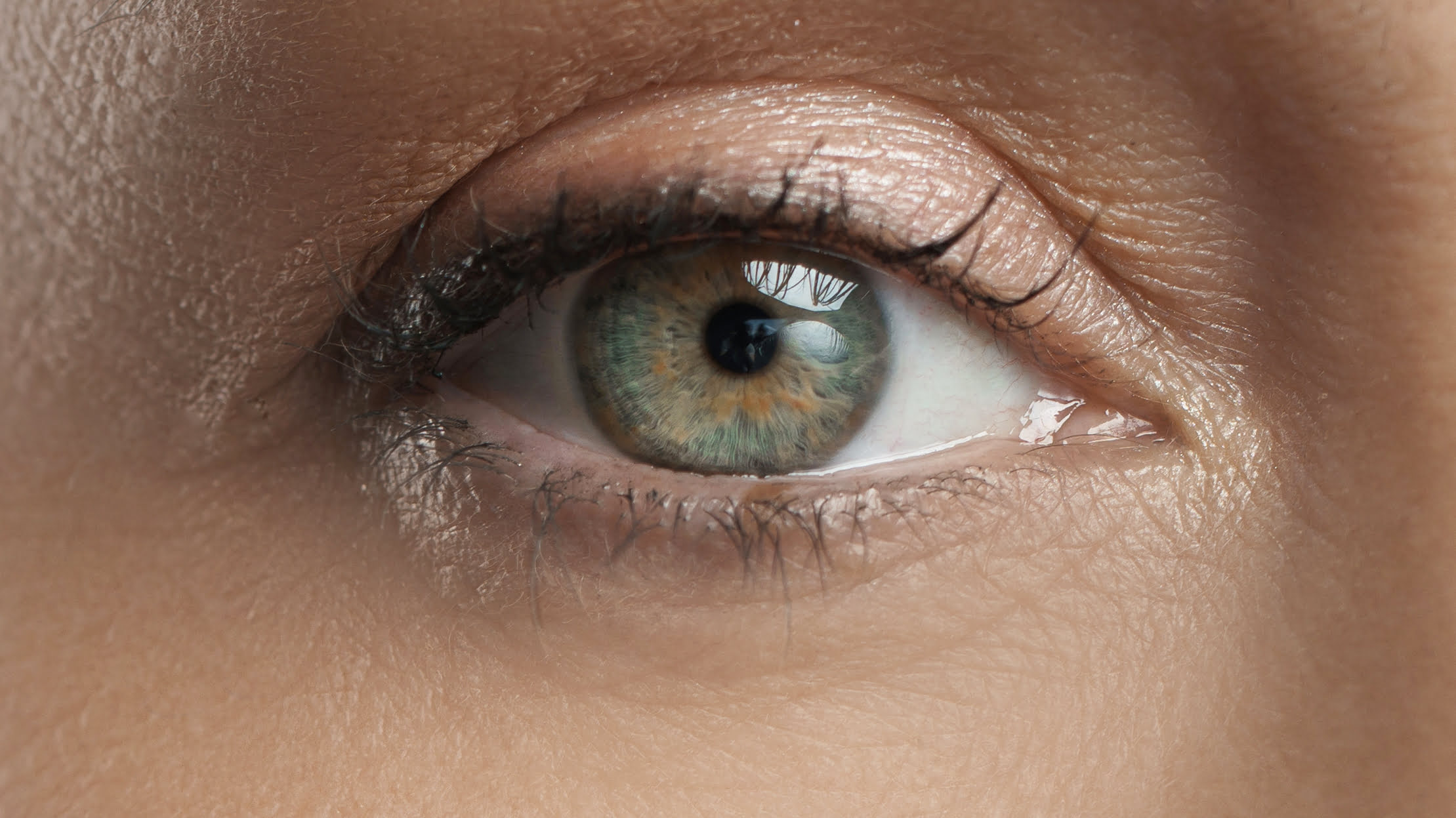 under eye wrinkles after treatment