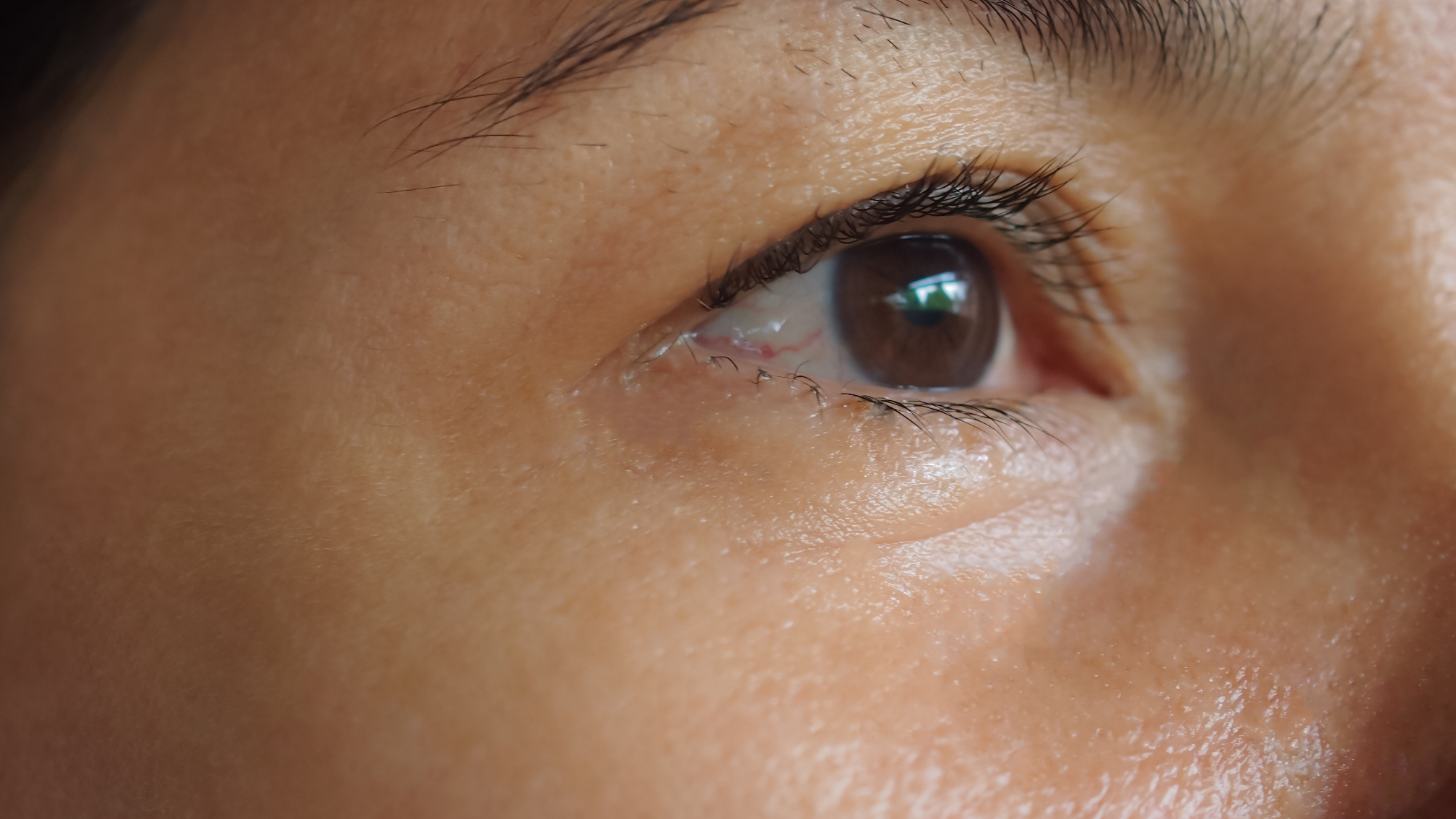 image,before,and,after,treatment,rejuvenation,surgery,on,face,asian