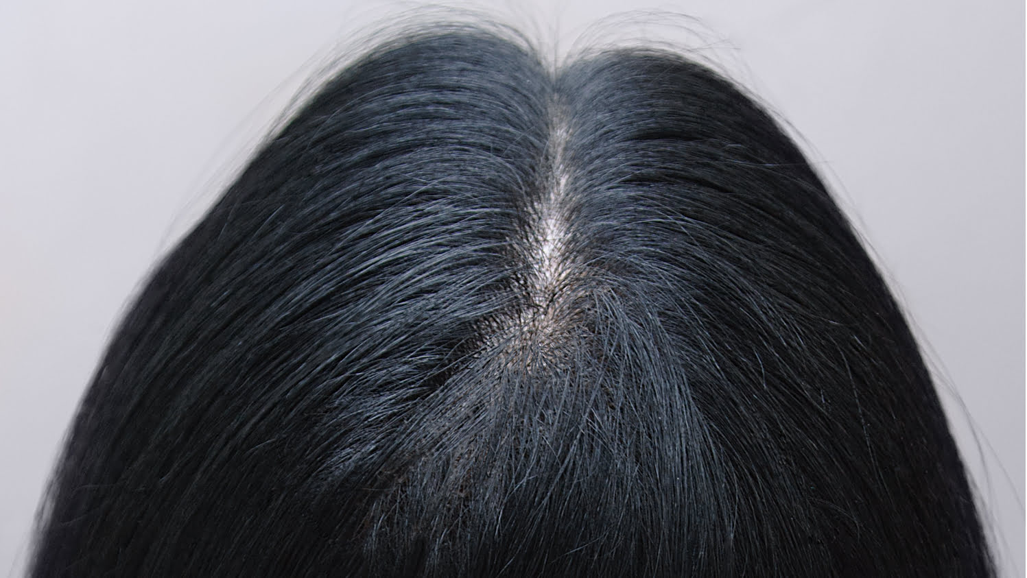 after hydrafacial scalp hair