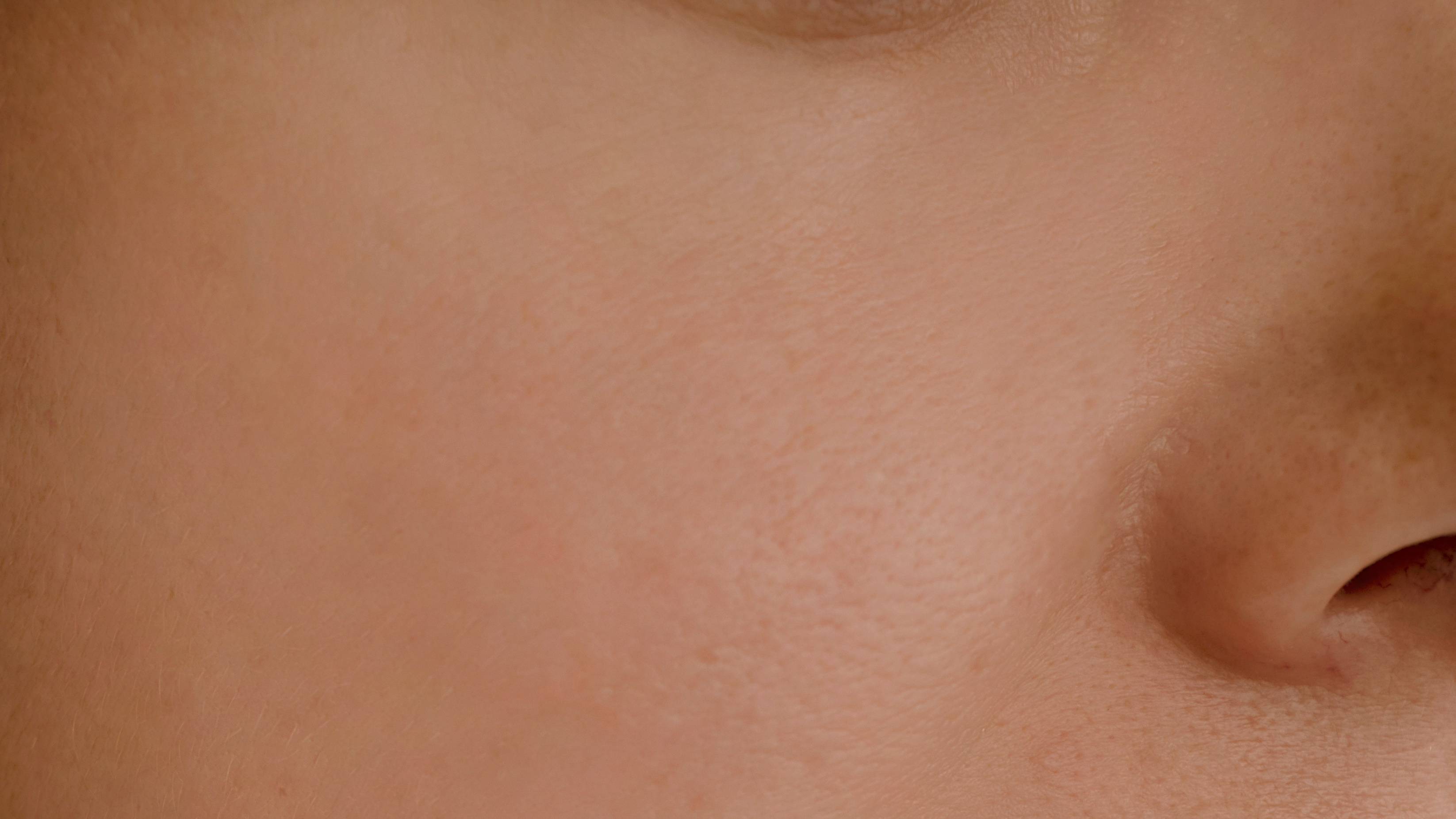 woman,face,wrinkles,before,and,after,treatment