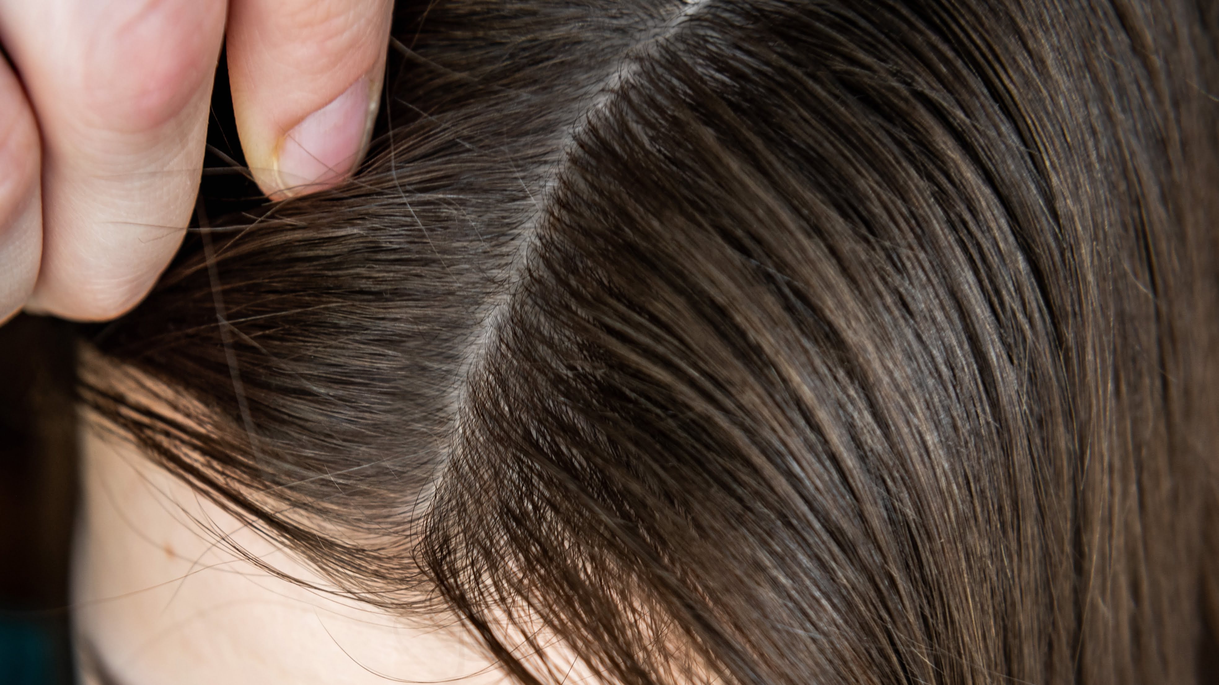 after prp hair boost