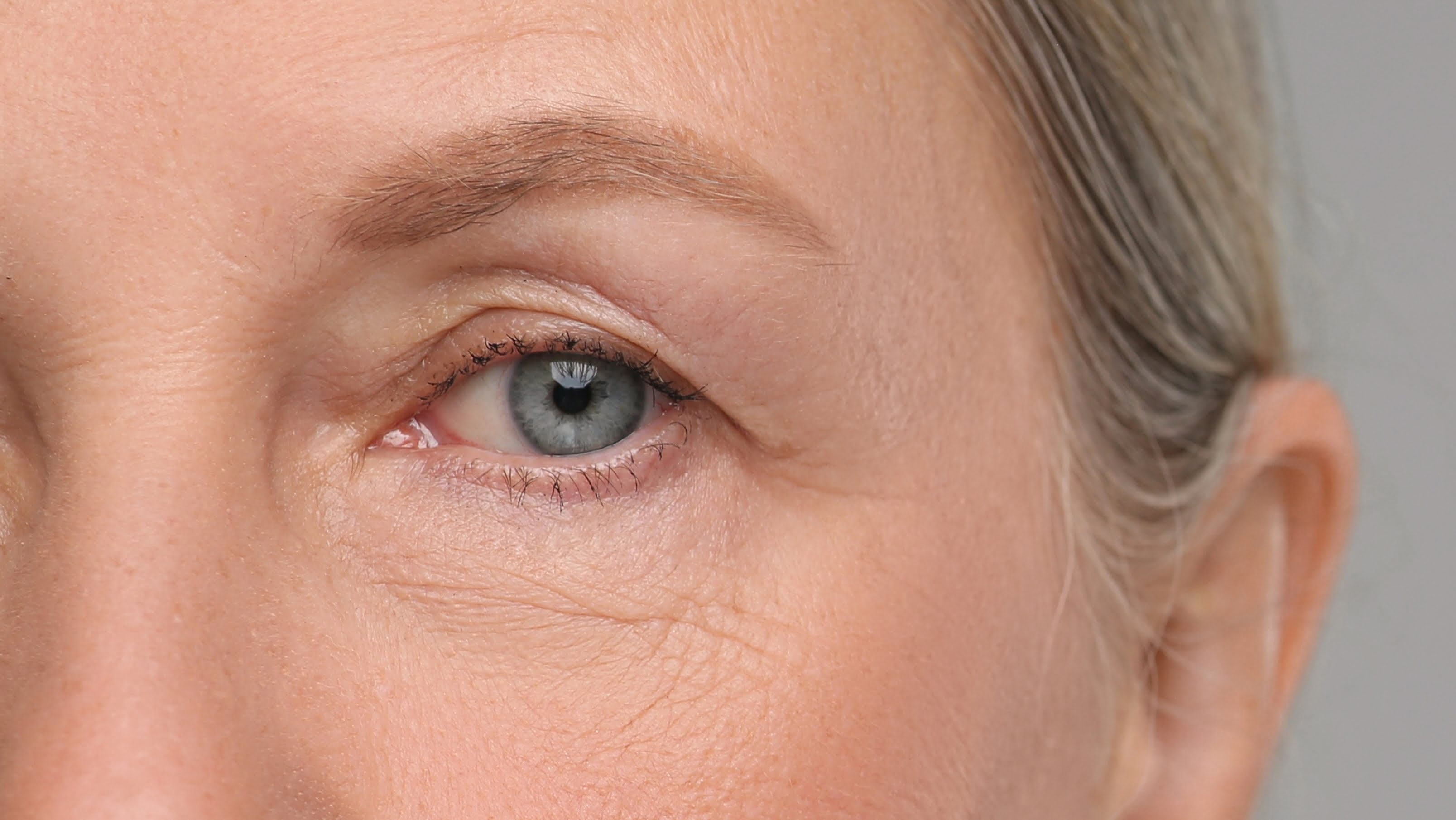 after polynucleotides treatment