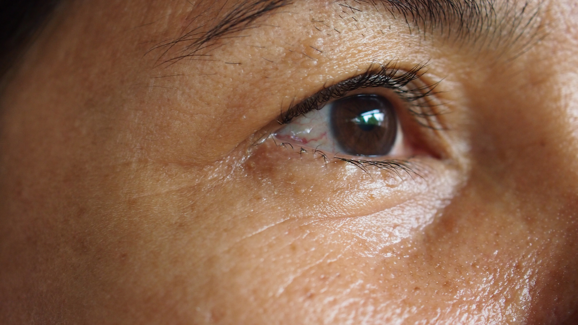 image,before,and,after,treatment,rejuvenation,surgery,on,face,asian