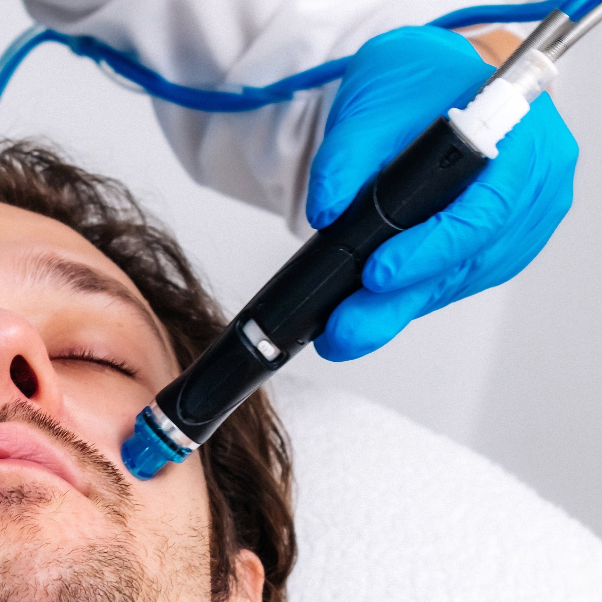 hydrafacial for men 2