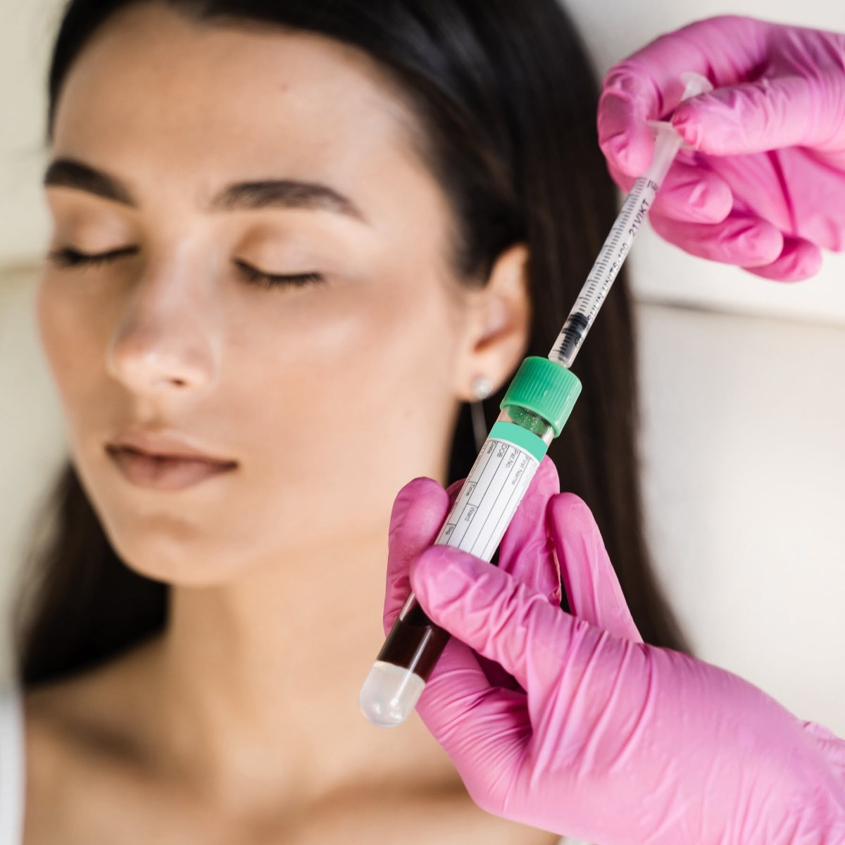 prp cellular matrix therapy.jpg