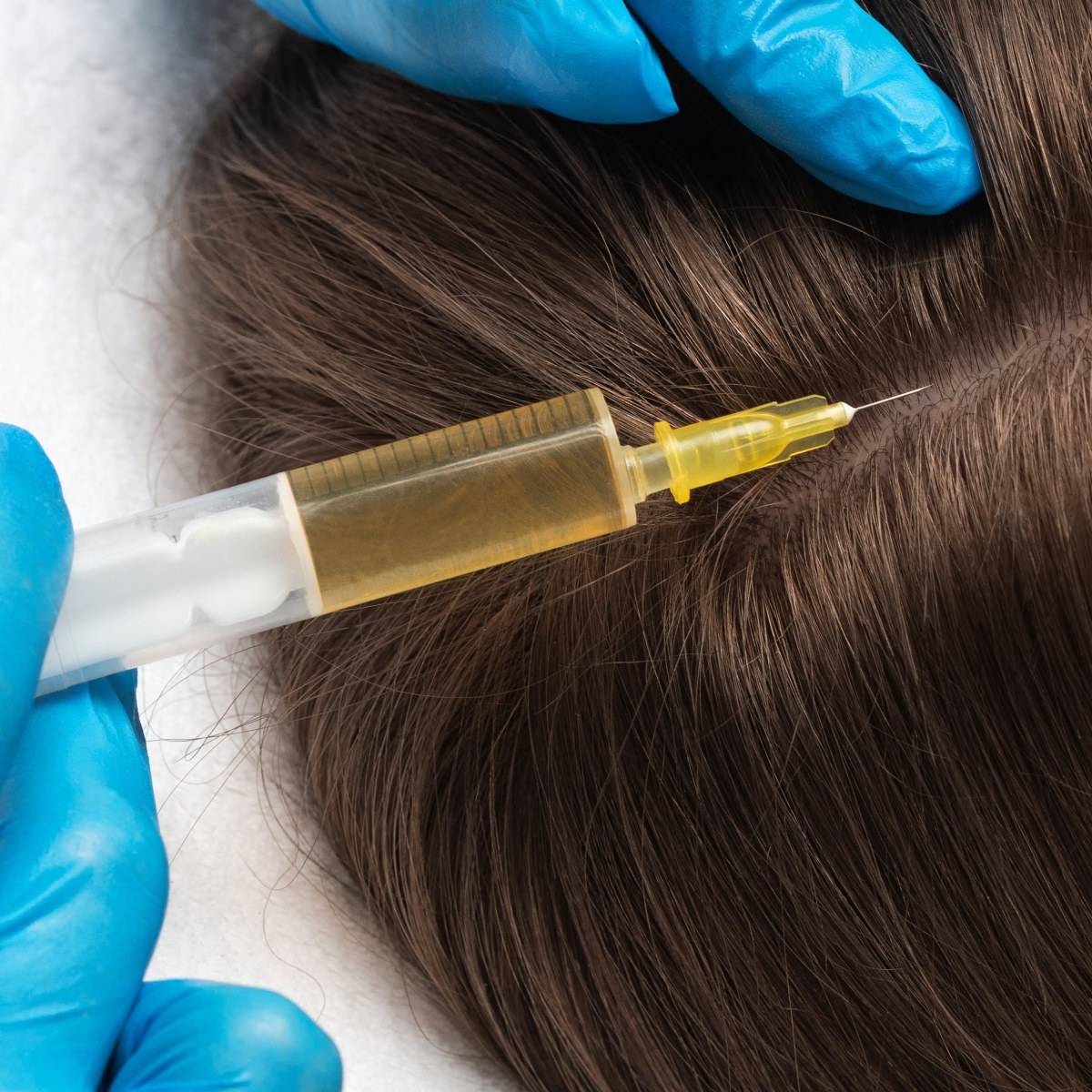 prp hair boost platelet rich plasma for hair restoration.jpg