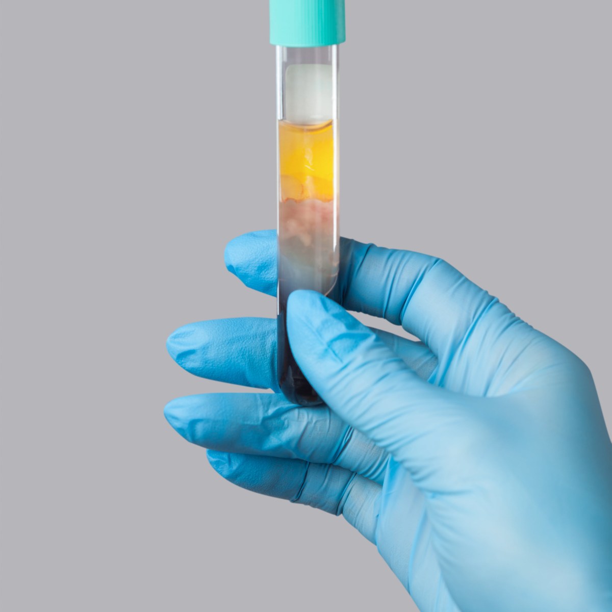 platelet rich plasma prp therapy.jpg
