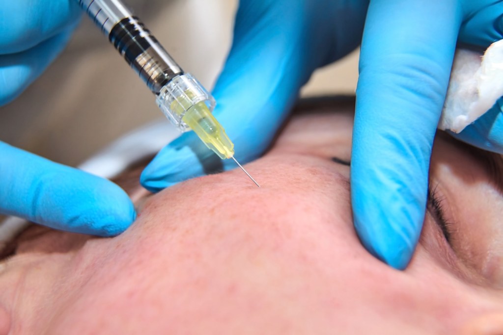 polynucleotides for men procedure