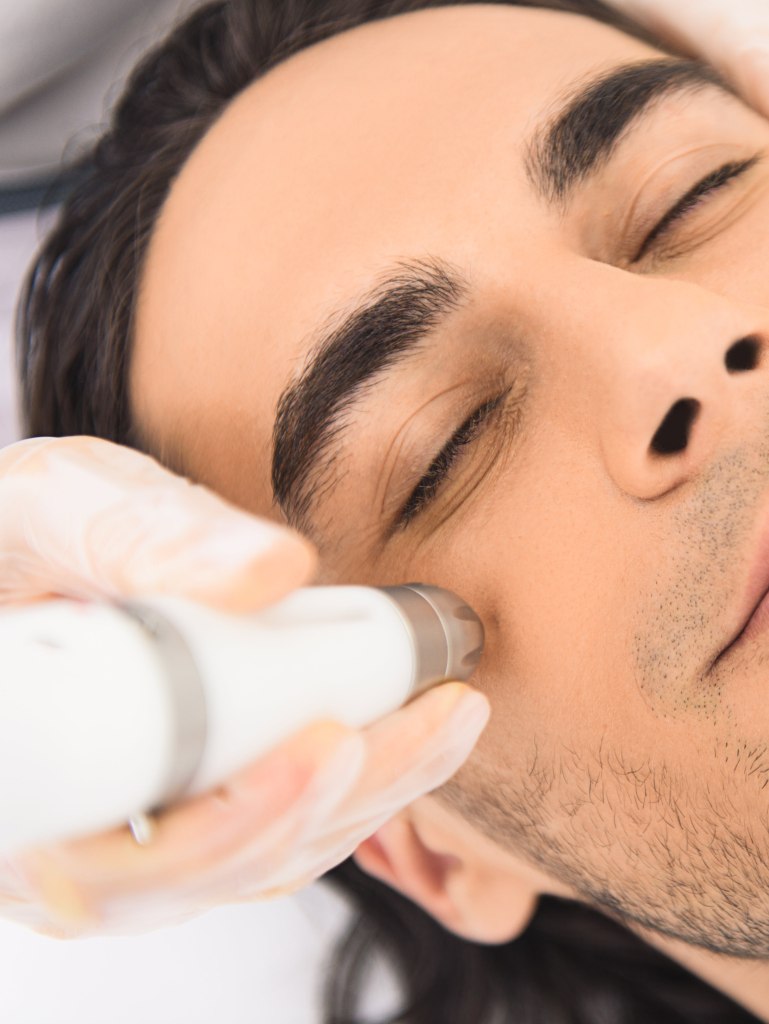 precisionlift procedure